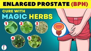 🔥 Magic Herbs to Cure Enlarged Prostate  Prostate enlargement Treatment  BPH Treatment [upl. by Carmine]