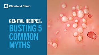 Busting 5 Myths About Genital Herpes [upl. by Stichter842]