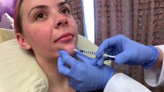 Botox for Chin Dimpling Preventing Wrinkles with Dr Michelle Ellern [upl. by Leinod80]