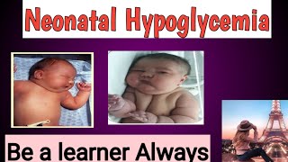 Neonatal Hypoglycemia [upl. by Felicle]