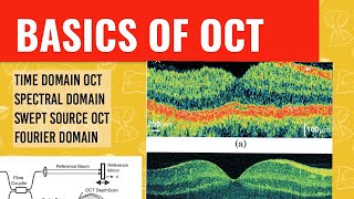 WHAT IS OCT  OCT technology explained [upl. by Marieann289]