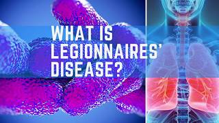 What is Legionnaires Disease [upl. by Pudens]