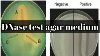 DNase test biochemical test lecture 15 [upl. by Kristoforo]