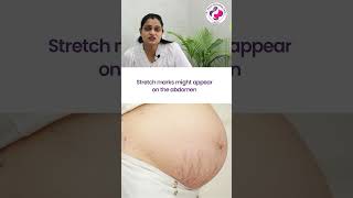 Changes in Mother at 21st Week of Pregnancy  21वें सप्ताह में माँ के शरीर में होने वाले बदलाव [upl. by Siahc]