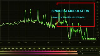 Acoustic Tinnitus Treatment  Binaural Modulation Sounds for Tinnitus Relief [upl. by Booze77]