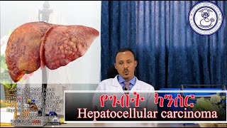 የጉበት ካንሰር ምንነት እና መፍትሄዎቹ Hepatocellular carcinoma and Its management [upl. by Dinnie59]