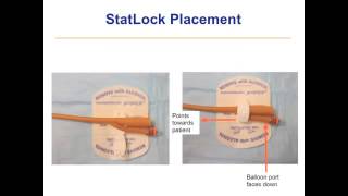 Catheterization Troubleshooting [upl. by Madigan]