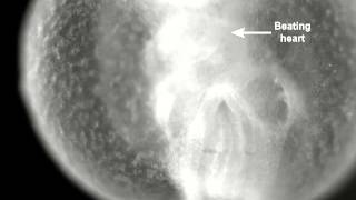 Heartbeat movie of an E85 mouse embryo after 12 h of WEC [upl. by Allicirp697]