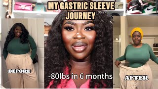 MY GASTRIC SLEEVE JOURNEY [upl. by Llezom]