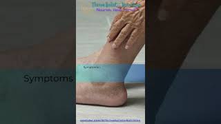 Charcot Joint Neuropathic Arthropathy [upl. by Airbas968]