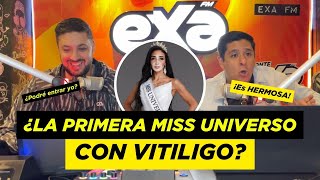 ¿La primera MISS UNIVERSO que tiene VITILIGO [upl. by Ahseenal]