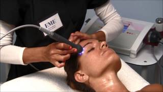 EME  Electroporation treatment with Lift Skin face [upl. by Fihsak]