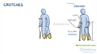 Assistive devices for Ambulation  Nursing  Osmosis [upl. by Reiter]