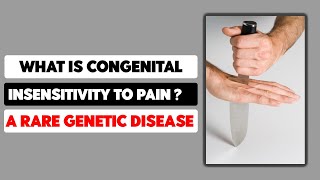 What is Congenital insensitivity to pain A Rare Genetic Disease [upl. by Judsen]