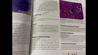 Mycology  Microbiology  Levinson [upl. by Norred319]