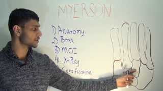 Myerson classification  LisFranc Injuries [upl. by Sihonn216]