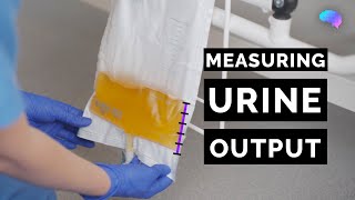 Measuring Urine Output  OSCE Guide  Catheter  UKMLA  CPSA [upl. by Ahsyia]