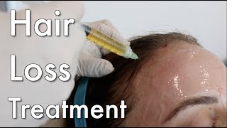 Hair Loss Treatment PRP [upl. by Nitsraek]