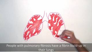 Systemic Enzyme Therapy and Pulmonary Fibrosis  Presented by Pulmonary Fibrosis NOW [upl. by Angid]