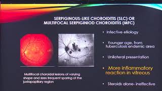 AIOC2020 IC559 T3 Dr Garima Lakhotia Serpiginous Choroiditis The creeping culprit [upl. by Ellitnahc]