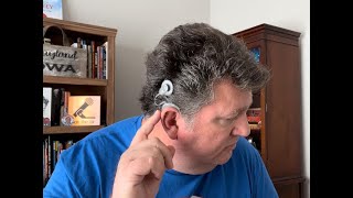 Hey How’s That Cochlear Implant Working [upl. by Codee]