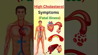 STOP Ignoring These Warning Signs of High Cholesterol [upl. by Idonna]