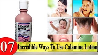 7 Incredible Ways To Use Calamine Lotion [upl. by Ilse]