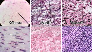 Identifying Connective Tissue  Review and Practice [upl. by Zelten]