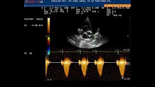 ESTENOSIS CONGENITA DE VALVULA PULMONAR GRAVE SEDICAR VET 67 [upl. by Floridia117]