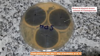 Cladosporium and Penicillium Colony Morphology on SDA and LPCB Preparation [upl. by Alyssa]