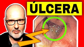 ÚLCERA GÁSTRICA o DUODENAL Síntomas Causas y Tratamiento [upl. by Kcirdorb]