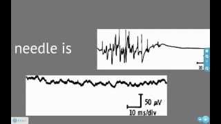 EMG and Action Potentials [upl. by Annek850]