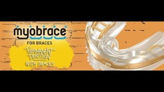 Myobrace for braces [upl. by Aizti]