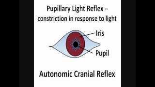 Pupillary Light Reflex  Cranial Nerves II amp III [upl. by Ruosnam]