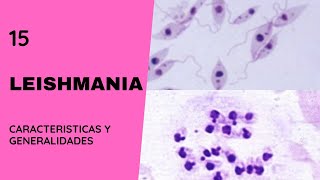 Leishmania 15  Leishmaniasis  Flagelados  Parasitosis [upl. by Orna500]