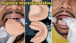 Alginate Impression Taking  Dental Impression  Alginate Impression [upl. by Ordnazil948]