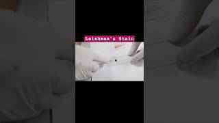 Blood smear preparationperipheral blood smear  blood smear leishmans stainbloodtestlaboratory [upl. by Laved]