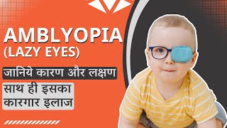 Amblyopia in kids  Lazy eyes  Causes amp treatment [upl. by Matheson]