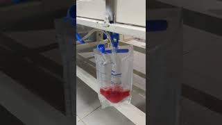 water seal drainage surgery pnuemothorax fluid level bubbling oscillation [upl. by Rosane642]