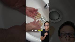 Fenômeno de Raynaud 😱medicina medico enfermeiro enfermagem curiosidades mão gelada e pálida [upl. by Parsaye]