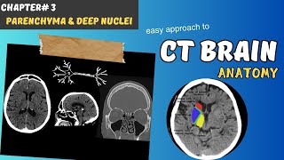 CT BRAIN Chapter 3 Parenchyma Internal capsule amp Deep Brain Nuclei Basal ganglia amp Thalamus [upl. by Canada]