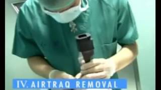 Airtraq Video Laryngoscope [upl. by Idleman]