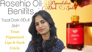 Vrikshveda Rosehip Oil Benifits  Uses Review  🤩 [upl. by Corine]