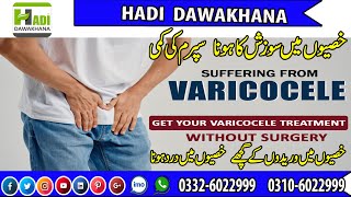 Varicocele Causes Symptoms Treatment without surgery  Varicocele ka ilaj in urdu  hindi [upl. by Bartholomeo992]