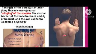 winging of scapulawinged scapulaanatomyupper limb2 marksviva voicein Tamil [upl. by Ellahcim529]