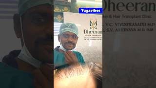 Hair transplant failure  Hair treatment shorts hair hairtransplant yugavibes [upl. by Enitsyrk462]