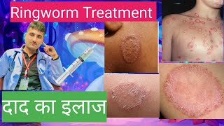 Ringworm Treatment  Fungal infection  दाद का इलाज  antifungal medicine [upl. by Jamnes]