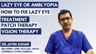 Amblyopia Lazy Eye  Meaning  Treatment of Amblyopia Lazy Eye  Patch amp Vision Therapy Exercise [upl. by Alesram]