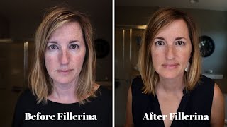 Fillerina Plumping System Review  BEFORE and AFTER [upl. by Hazlett]