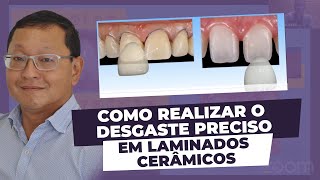 Como realizar preparos para laminados cerâmicos [upl. by Sylram]